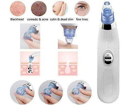 Blackhead Remover Vacuum Suction Quantity